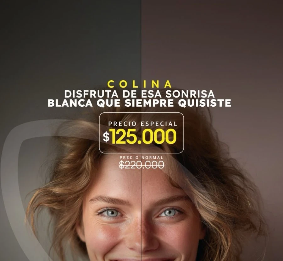 Blanqueamiento dental